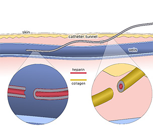 Pediatric Technologies